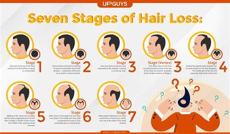 Infographic: Stages and Types of Hair Loss