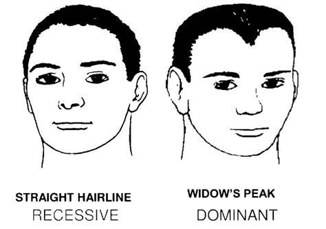 infographic comparing widow's peak and receding hairline
