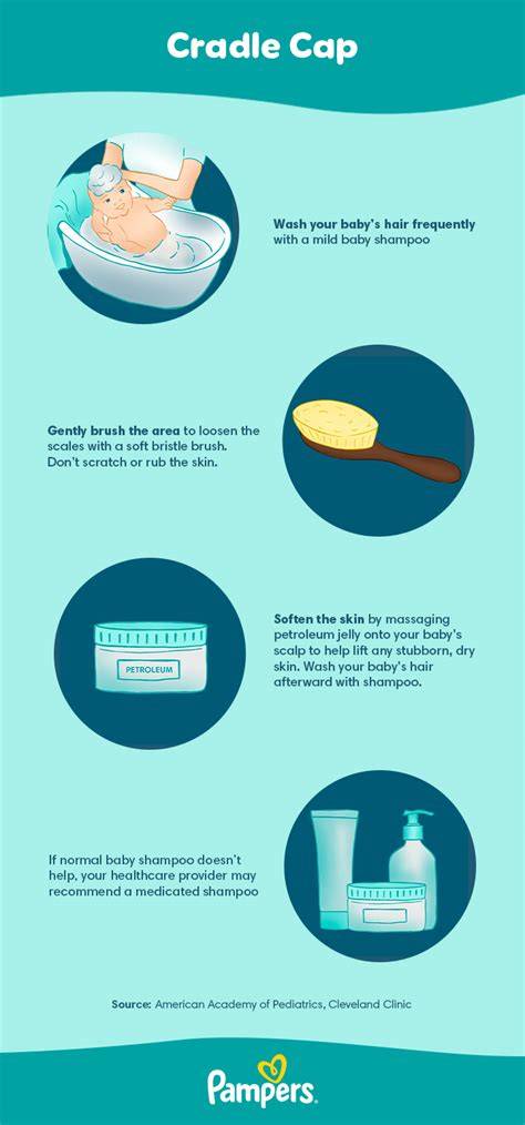 infographic cradle cap symptoms and location