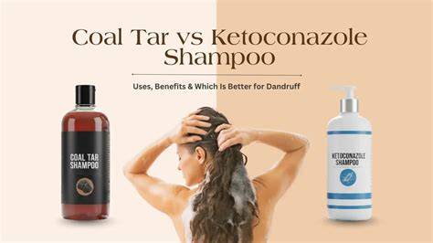 ketoconazole vs zinc vs coal tar infographic