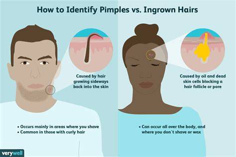 infographic explaining ingrown hair prevention