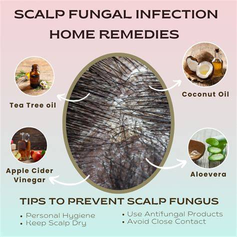 Scalp fungal infection treatment